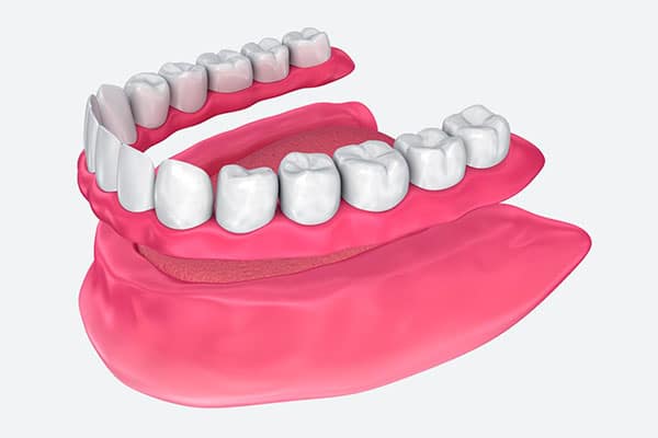 Prótese dentária total removível | Dra. Laíse Cunha